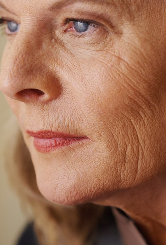 Frustrated With Skin Wrinkles