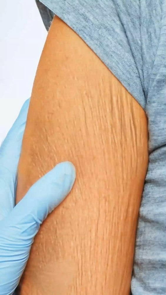 Skin Firmness Struggles